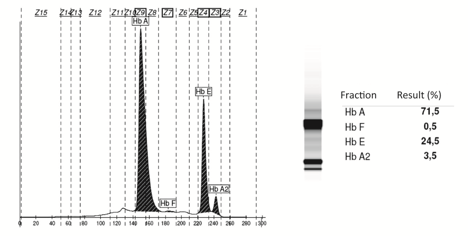 https://mail.biochemia-medica.biz.hr/assets/images/upload/xml_tif/bm-26-451-f1.png