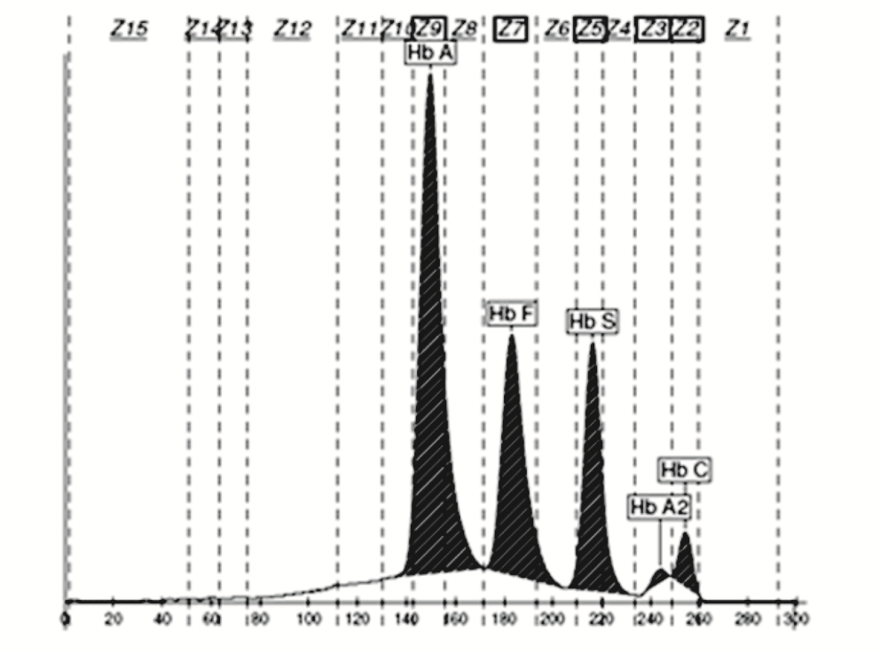https://mail.biochemia-medica.biz.hr/assets/images/upload/xml_tif/bm-26-451-f2.png