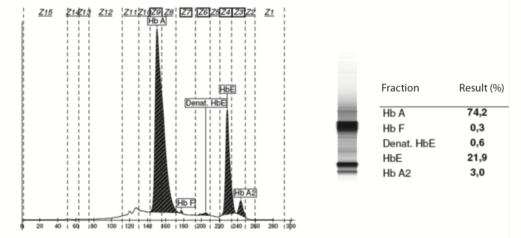 https://mail.biochemia-medica.biz.hr/assets/images/upload/xml_tif/bm-26-451-f3.png