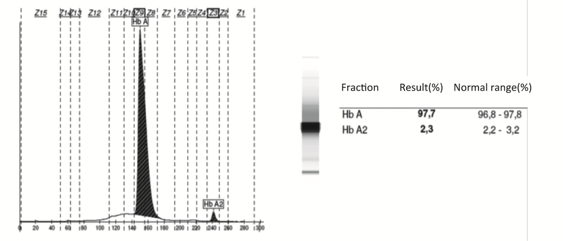 https://mail.biochemia-medica.biz.hr/assets/images/upload/xml_tif/bm-26-451-f4.png