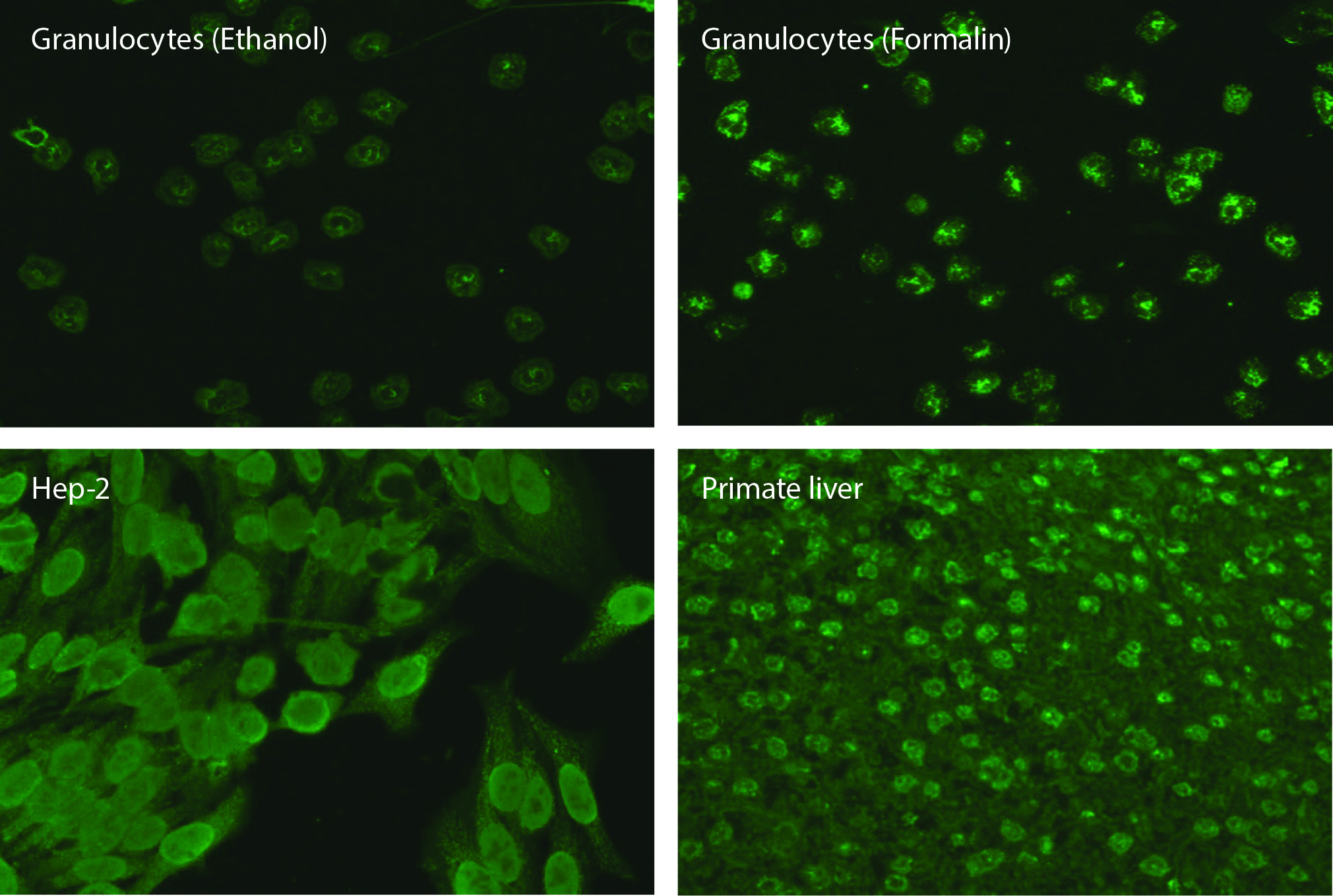 https://mail.biochemia-medica.biz.hr/assets/images/upload/xml_tif/bm-33-3-031001-f1.png