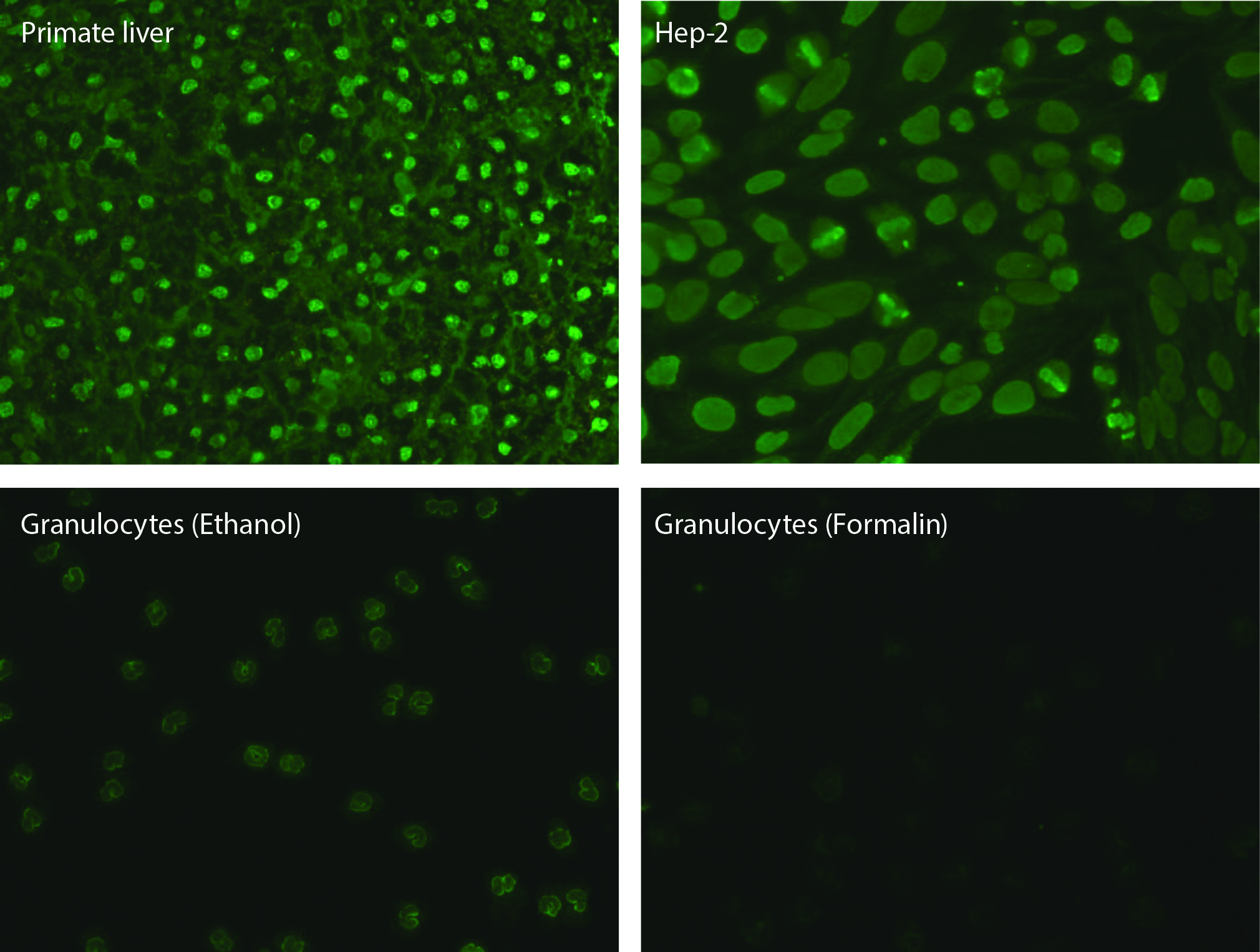 https://mail.biochemia-medica.biz.hr/assets/images/upload/xml_tif/bm-33-3-031001-f2.png