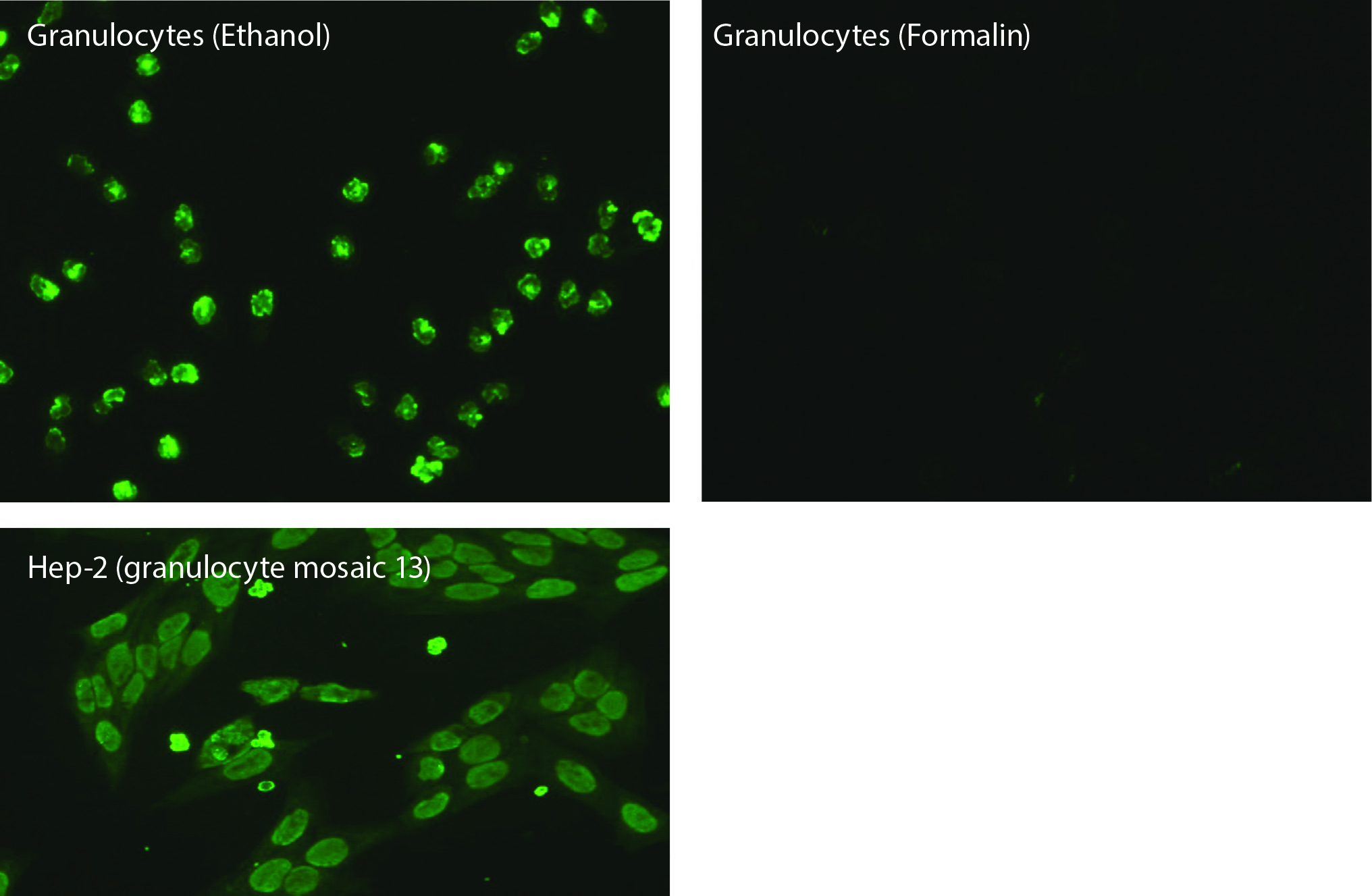 https://mail.biochemia-medica.biz.hr/assets/images/upload/xml_tif/bm-33-3-031001-f3.png