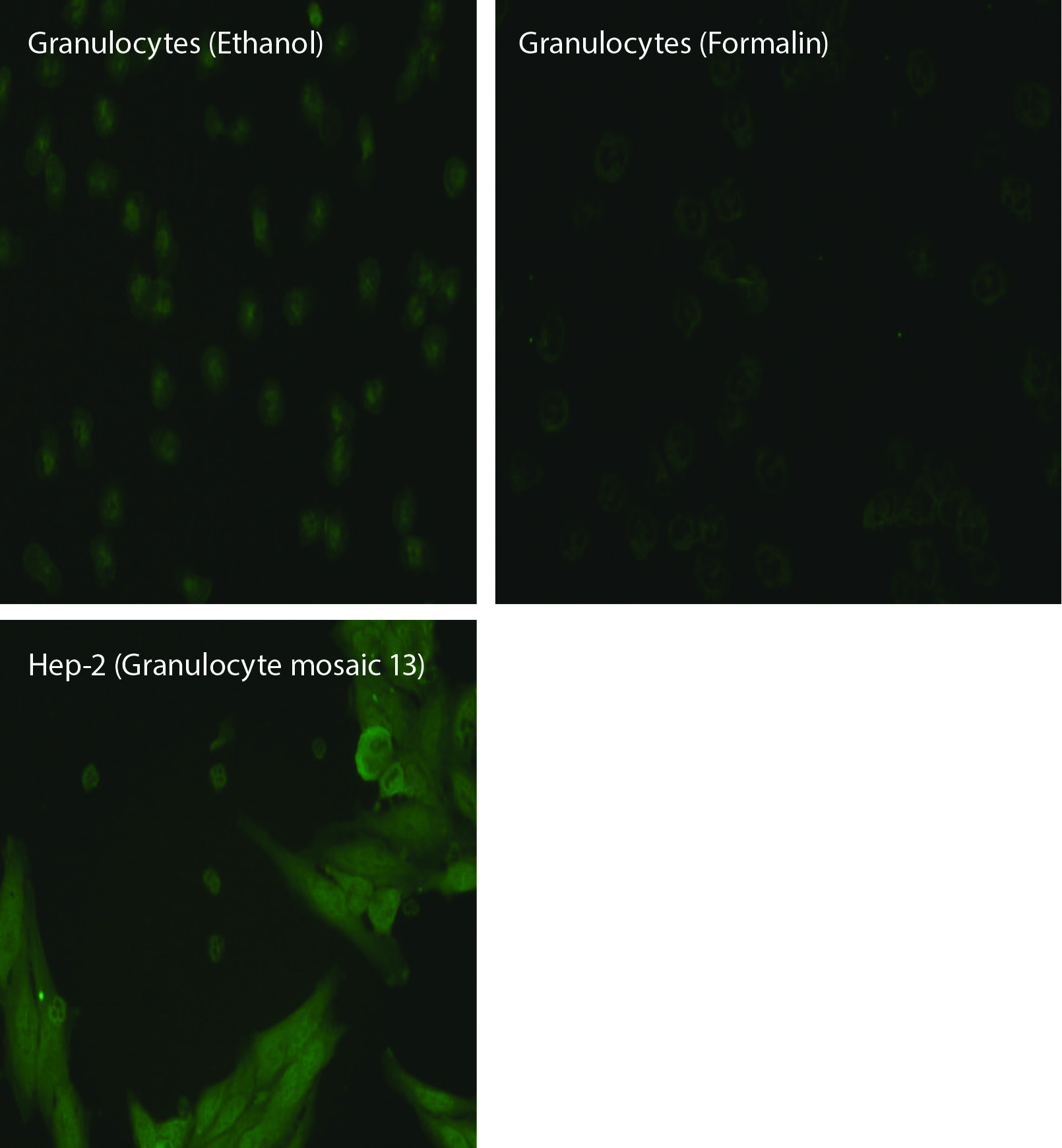 https://mail.biochemia-medica.biz.hr/assets/images/upload/xml_tif/bm-33-3-031001-f4.png