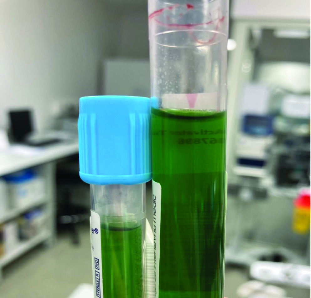 https://mail.biochemia-medica.biz.hr/assets/images/upload/xml_tif/bm-35-1-011001-f1.png